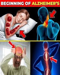 7 Early Signs of Alzheimer’s Disease You Shouldn’t Ignore